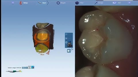 Live View Image Capture