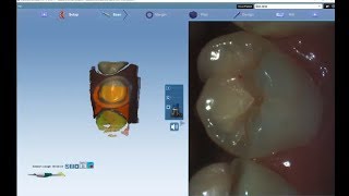 Live View Image Capture