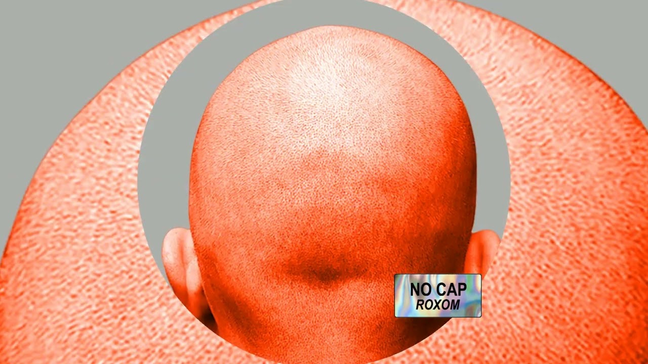 Guarda ROXOM - No Cap (radio edit) su YouTube Guarda ROXOM - No Cap (radio edit) su YouTube