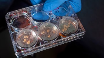 Scientists grow mini brains with eyes in lab || mini brain with eyes