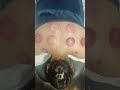 cupping therapy @kinimakeover #skintreatment #bodytreatments #hairtreatment