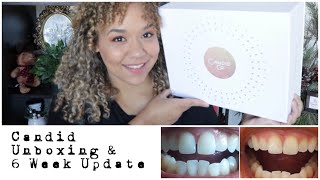 Candid Aligners Unboxing and Teeth Update