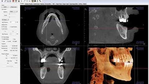 Invivo™ 5.4.5 Training Series: File Management and Navigation