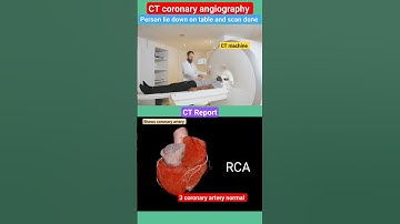 Thumbnail of CT coronary angiography l #heart #coronaryartery #shorts