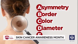Sun safety reminders for Skin Cancer Awareness Month