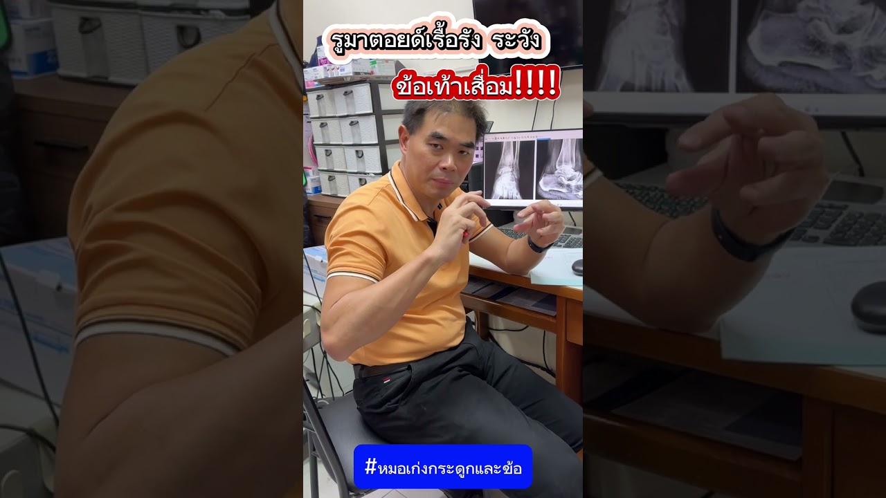 รูมาตอยด์ ปวดเรื้อรัง ระวังข้อเท้าเสื่อม #หมอเก่งกระดูกและข้อ #รูมาตอยด์ #ปวดข้อเท้า #ข้อเท้าเสื่อม