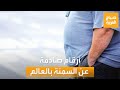 صباح العربية الكويت الأولى عربيا نصف سكان العالم معرضون للإصابة بالسمنة