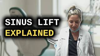 Sinus Lift for Dental Implants Explained: Vertical Sinus Augmentation