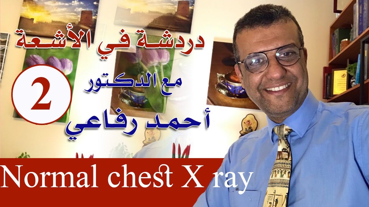 دردشة فى الأشعة  - normal chest x ray -  د. أحمد رفاعي