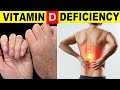 7 Signs Your Body Is Begging for Vitamin D