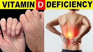 7 Signs Your Body Is Begging for Vitamin D