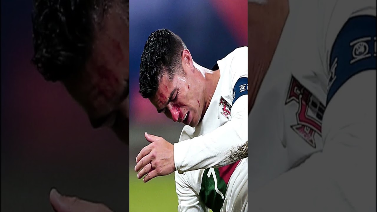 CR7 face damage iset 