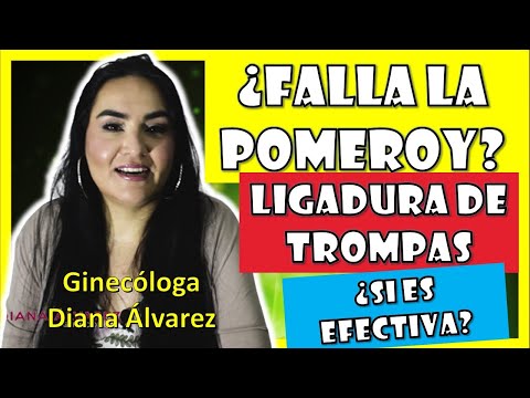 Video: ¿Por qué falla la ligadura de trompas?