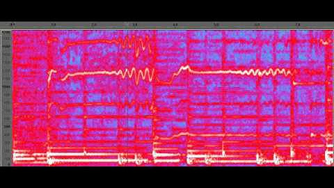 Bohemian Rhapsody clip