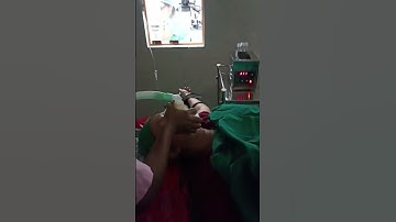 OVUM PICK UP    #shorts #viral #shortvideo