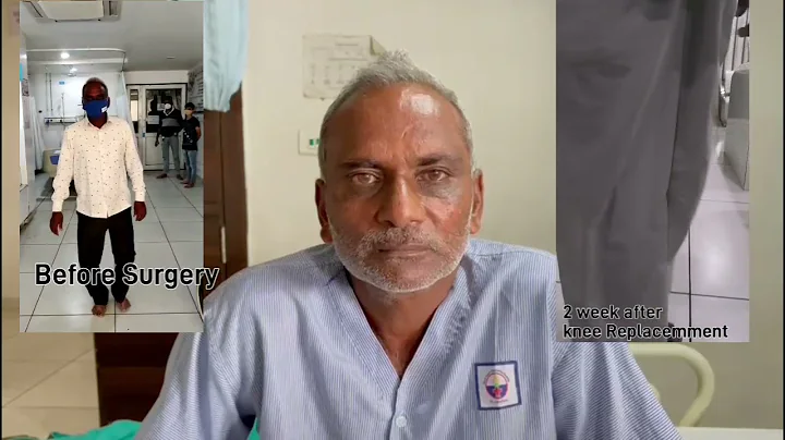 Before and After knee Replacement video / Dr.  Ris...