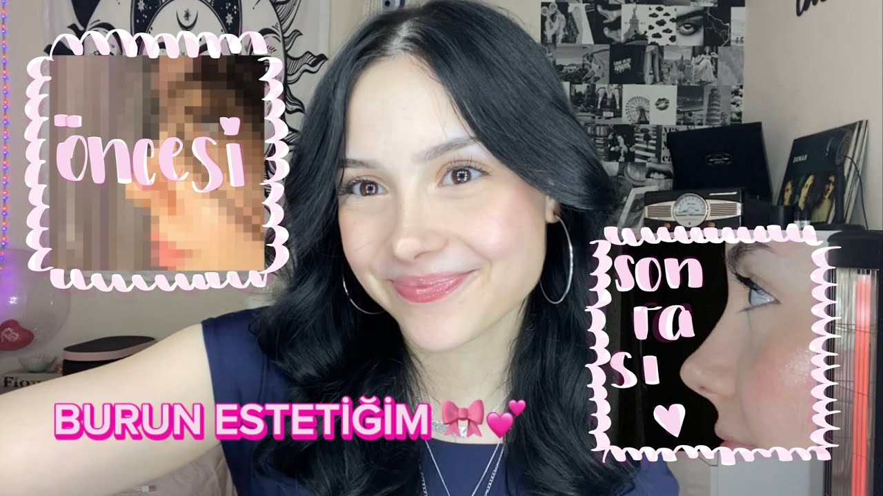 BURUN ESTETİĞİ HAKKINDA HER ŞEY 🧿 rinoplasti olmadan önce bilmeniz gerekenler 🤍✨