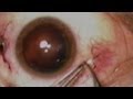 Gray's Anatomy - Eyeball Surgery