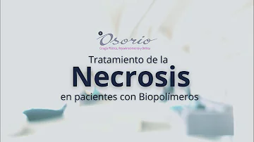 ¿Cómo se diagnostica la necrosis?