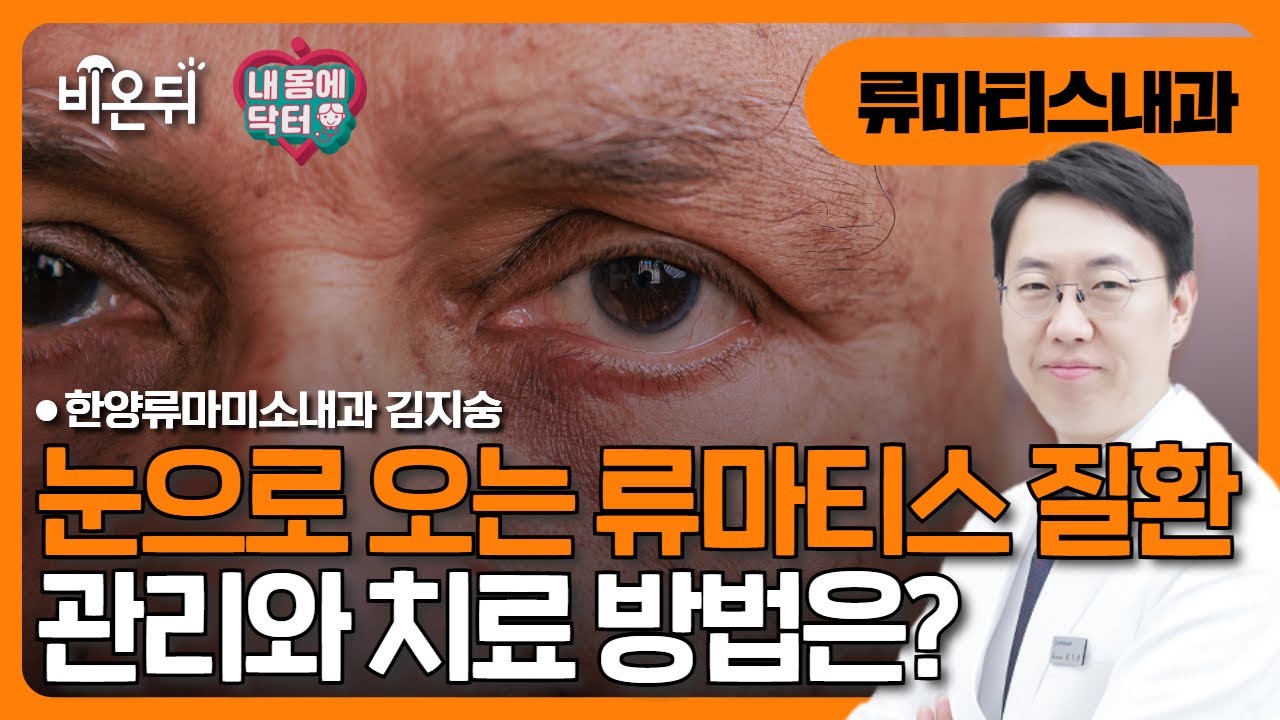 [내몸에닥터] 눈으로 오는 류마티스 질환 / 한양류마미소내과 김지숭