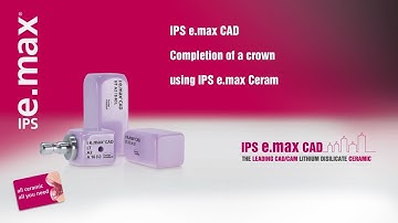 IPS e.max CAD: Completion of a crown using IPS e max Ceram