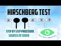 Hirschberg corneal reflex test