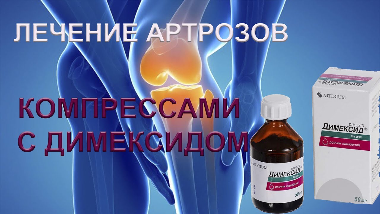 Постановка компресса с Димексидом на коленный сустав#лечитьартроз# ...