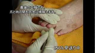 老人ホームでのフスフレーゲを見てきた Part1爪水虫 靴業界を元気にするnpo法人シューネクストblog 老人ホームでのフスフレーゲを見てきた Part1爪水虫 靴業界を元気にするnpo法人シューネクストblog