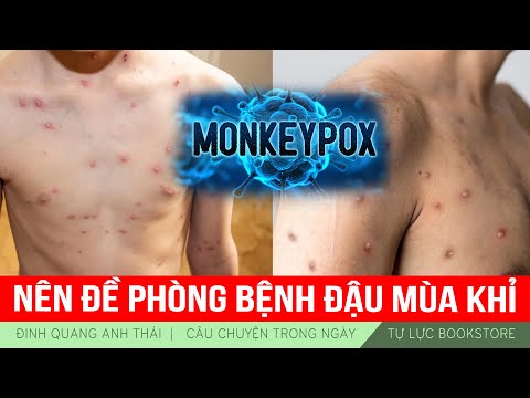 Video: Tại sao con trai của Yuri Nikulin xúc phạm cha mình trong nhiều năm