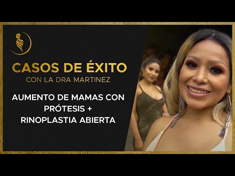 Las Hermanas Poma