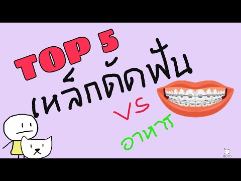 5 อันดับ อาหารที่คนดัดฟันโคตรจะเกลียด