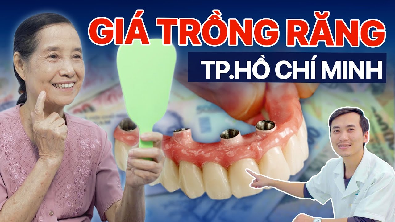 Outline Video Bảng Giá Trồng Răng Implant Trọn Gói Tại Tp. HCM - Cách Tính Giá Chuẩn Cho Từng Trường Hợp!