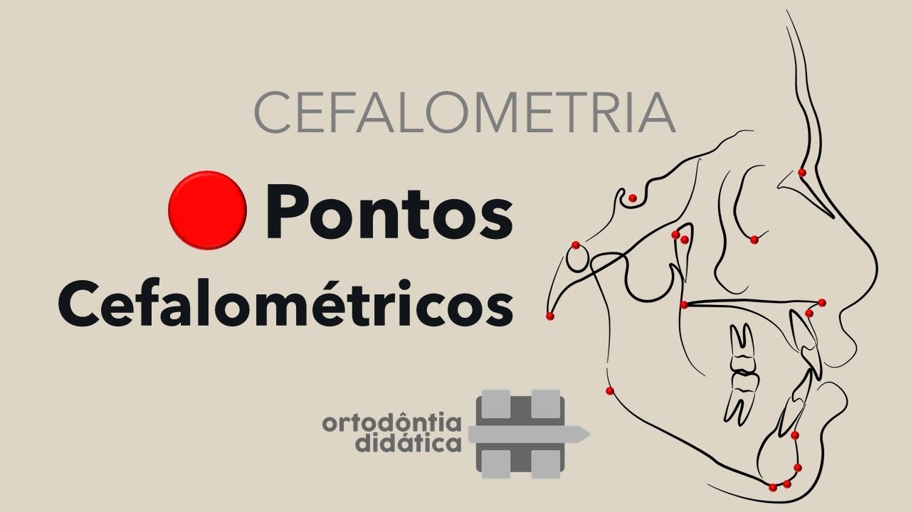 Cefalometria - Pontos Cefalométricos