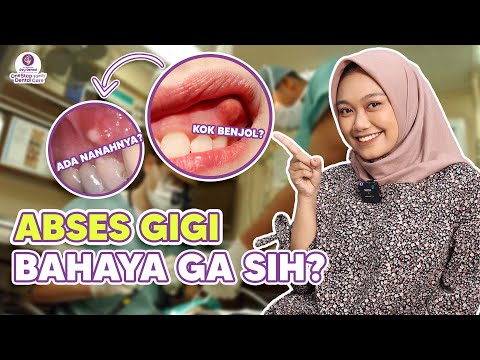 Video: Cara Mengidentifikasi Abses Gigi: 10 Langkah (dengan Gambar)