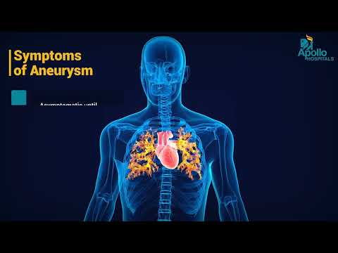 Dr. Balaji V | Aortic Aneurysms Explained: Risks, Symptoms & Modern Treatments | Apollo Hospitals