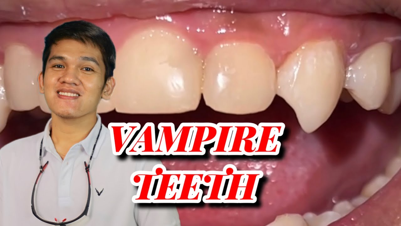 VAMPIRE TEETH 🦷 YouTube