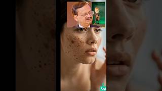 Home Remedy for Pigmentation/Darkspots |Dr Subhash Goyal #shorts #viral #pigmentation #youtubeshorts