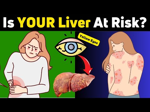 8 Signs You