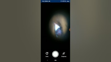 The Diabetic Retinopathy diagnosis app demo