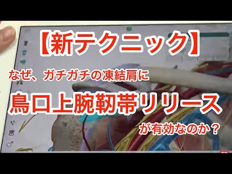 医師　理学療法士　筋膜リリース　【新テクニック】なぜ、ガチガチの凍結肩に鳥口上腕靭帯リリース　【frozen shoulder】 Wavy brachial ligament release