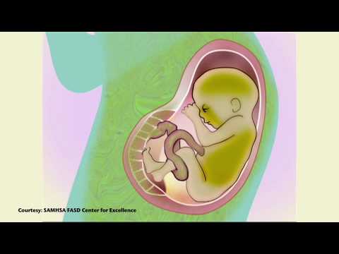 FASD Patient Education Video - Newborn Channel Version