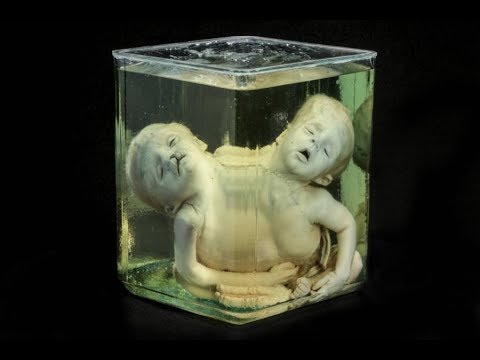 Video: Museos de Curiosidades Médicas, Taxidermia y Anatomía