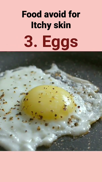 Top 5 food avoid for itchy skin| #skincare #food