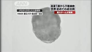 血液1滴からiPS細胞作るのに成功　慶応大学（10/07/02）
