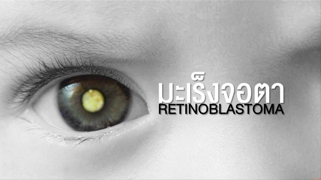 ศิริราช360° [by Mahidol] เด็กตาวาว (1/2)