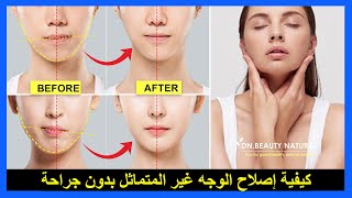 كيفية إصلاح الوجه غير المتماثل بدون جراحة