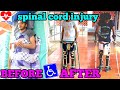 spinal cord injury paraplegic walking after rehabilitation