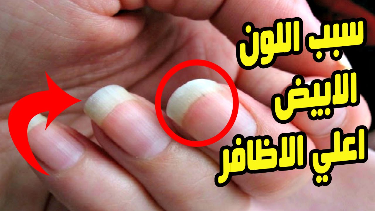 هل تعلم ما الذي يجعل أظافرك بيضاء اللون عندما يزداد طولها؟!!