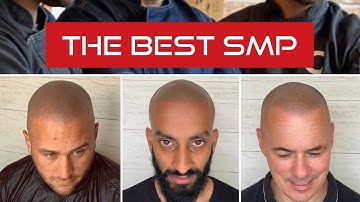 The Best Scalp MicroPigmentation - Ultra Natural Incredible Results at Creative Scalps