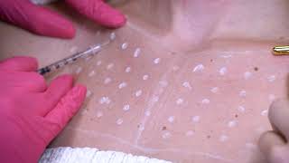 Microtox